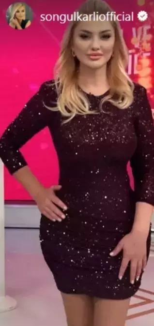 Estetik İddiaları bitmiyor! Songül Karlı'dan yanıt geldi