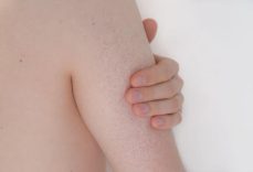 Vücutta Kırmızı Lekeler Neden Olur? Vücuttaki Kırmızı Lekeler noktalar Nasıl Geçer?