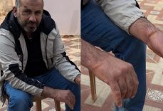 Batı Şeria’da İsrail işkencesi